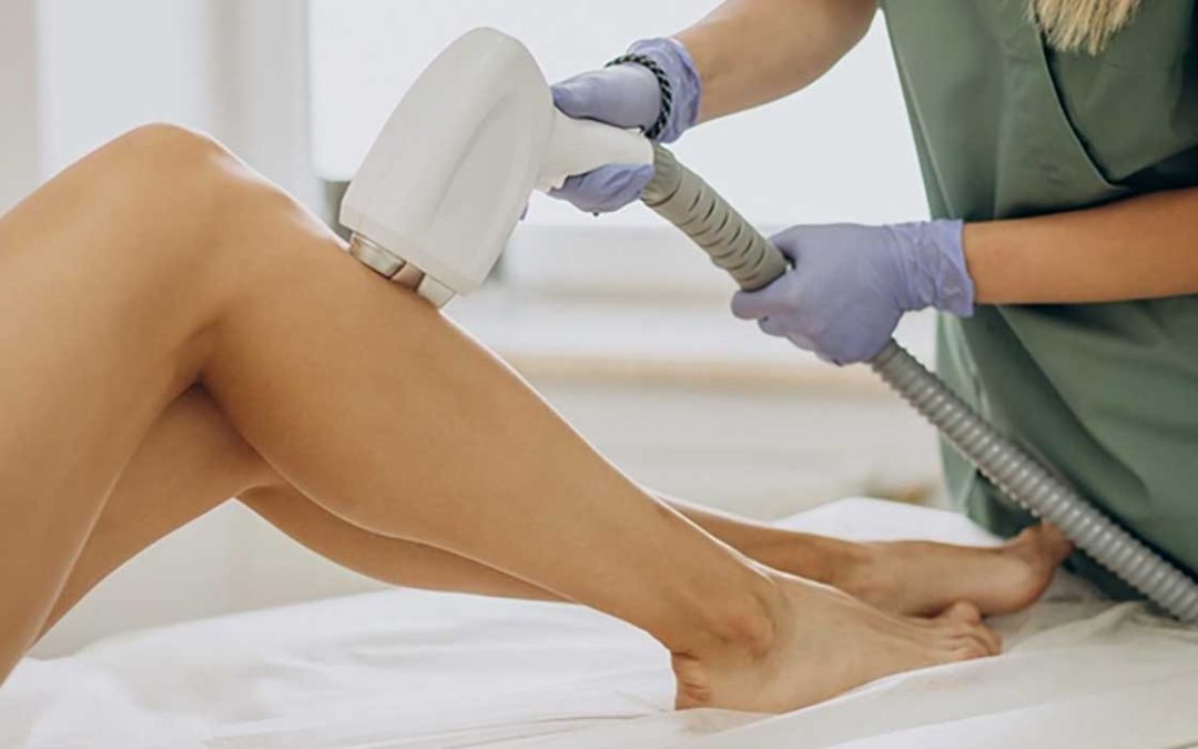 Qué es el láser diodo y cómo funciona