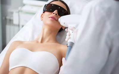 Descubre la Depilación Láser en el Labio Superior: Efectividad y Beneficios